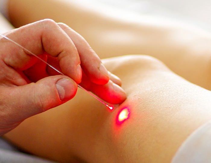 Лазеротерапия - Санаторий «Ченки»